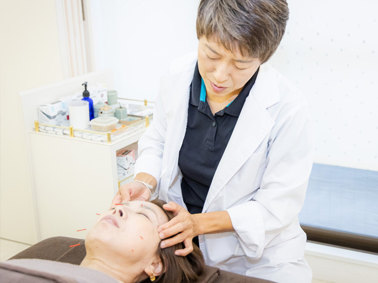 美容鍼の施術の様子